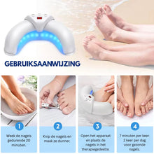 Afbeelding in Gallery-weergave laden, PureNail - Gepatenteerde nagelschimmeltherapie – voor gezonde nagels binnen 4 weken
